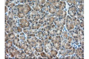 Immunohistochemical staining of paraffin-embedded Human liver tissue using anti-PDE4A mouse monoclonal antibody. (PDE4A 抗体)