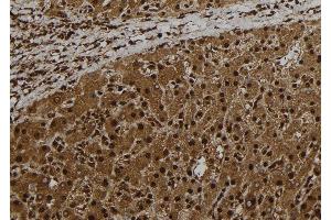 ABIN6278751 at 1/100 staining Human liver tissue by IHC-P. (CT47A1 抗体)