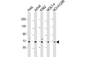 All lanes : Anti-NUP85 Antibody (N-Term) at 1:2000 dilution Lane 1: Hela whole cell lysate Lane 2: Jurkat whole cell lysate Lane 3: K562 whole cell lysate Lane 4: MOLT-4 whole cell lysate Lane 5: NCI- whole cell lysate Lysates/proteins at 20 μg per lane. (NUP85 抗体  (AA 163-195))