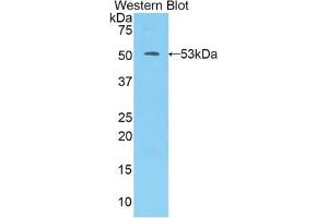 Western blot analysis of the recombinant protein. (Kallikrein 7 抗体  (AA 23-253))