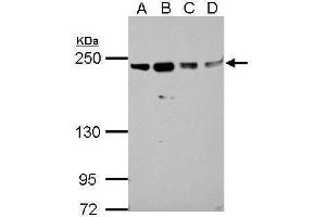 WB Image Sample (30 ug of whole cell lysate) A: A549 B: H1299 C: HCT116 D: MCF-7 5% SDS PAGE antibody diluted at 1:1000 (SLK 抗体)