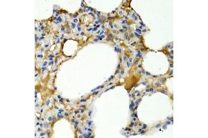 Immunohistochemistry of paraffin-embedded rat lung using IL9 antibody (ABIN3015677, ABIN3015678, ABIN1680463 and ABIN6219030) at dilution of 1:200 (40x lens). (IL-9 抗体  (AA 19-144))