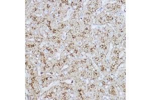 Immunohistochemistry of paraffin-embedded human liver using L Rabbit pAb (ABIN6129969, ABIN6143081, ABIN6143082 and ABIN6218224) at dilution of 1:200 (40x lens). (LAMP2 抗体  (AA 30-300))