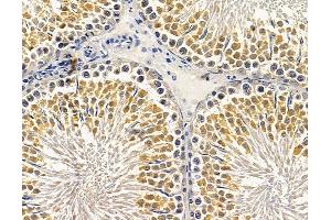 anti-ADAMTS-Like 3 (ADAMTSL3) antibody