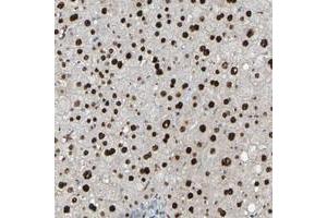 Immunohistochemical staining of human liver with USP36 polyclonal antibody  shows strong nuclear positivity in hepatocytes at 1:20-1:50 dilution. (USP36 抗体)