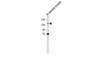 Anti-BCORL1 Antibody (N-term) at 1:500 dilution + Rat skeletal muscle lysate Lysates/proteins at 20 μg per lane.