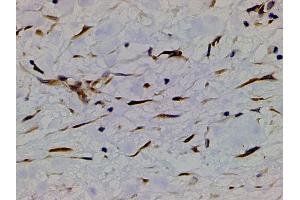 Immunohistochemistry (IHC) image for anti-Phosphoinositide 3 Kinase, p85 alpha (PI3K p85a) (pTyr607) antibody (ABIN6256775)