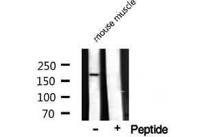 Western blot analysis on mouse muscle lysate using TOP2A Antibody (Topoisomerase II alpha 抗体  (Internal Region))