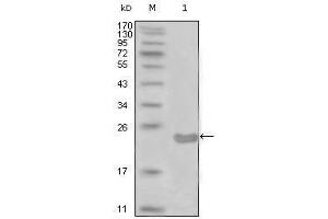 Western blot analysis using CD10 mouse mAb against truncated CD10-His recombinant protein (1). (MME 抗体)