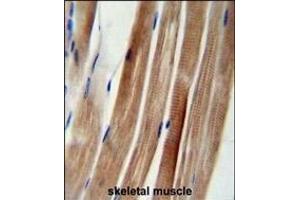 KI Antibody (Center) (ABIN654704 and ABIN2844396) immunohistochemistry analysis in formalin fixed and paraffin embedded human skeletal muscle followed by peroxidase conjugation of the secondary antibody and DAB staining. (KANSL3 抗体  (AA 398-427))