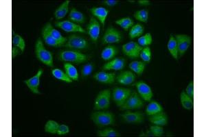 Immunofluorescence staining of Hela cells with ABIN7158919 at 1:166, counter-stained with DAPI. (MFSD4 抗体  (AA 160-220))