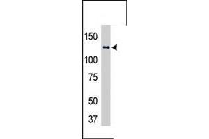 The USP25 polyclonal antibody  is used in Western blot to detect USP25-transfected HeLa cell lysates . (USP25 抗体  (C-Term))