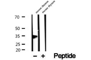 Western blot analysis of extracts of mouse thymus tissue, using PHF11 antibody. (PHF11 抗体  (C-Term))