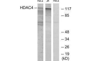 Western blot analysis of extracts from HeLa/Jurkat cells, using HDAC4 (Ab-632) antibody. (HDAC4 抗体  (Ser632))