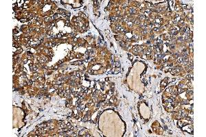 IHC analysis of IRBIT/AHCYL1 using anti-IRBIT/AHCYL1 antibody (ABIN7600030). (AHCYL1 抗体  (AA 14-57))