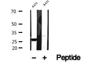 Western blot analysis of extracts of A431 cells, using CHCHD3 antibody. (CHCHD3 抗体  (N-Term))