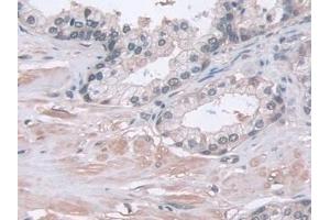 Immunohistochemistry (IHC) image for anti-Proteasome Subunit alpha 5 (PSMA5) (AA 1-241) antibody (ABIN7441322)
