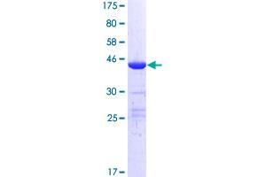 MED22 Protein (AA 1-140) (GST tag)