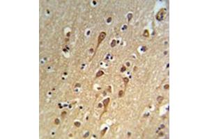 Immunohistochemistry analysis in formalin fixed and paraffin embedded brain tissue reacted with URG4 Antibody (Center) followed which was peroxidase conjugated to the secondary antibody and followed by DAB staining.