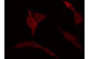 ABIN6274157 staining HuvEc cells by IF/ICC. (Homeobox C6 抗体  (N-Term))