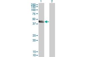 Western Blot analysis of SERPINE1 expression in transfected 293T cell line by SERPINE1 monoclonal antibody (M01), clone 3F2. (PAI1 抗体  (AA 86-185))