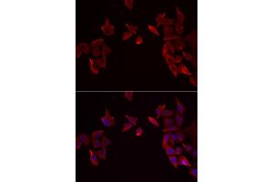 Immunofluorescence analysis of MCF-7 cells using RAMP3 antibody.