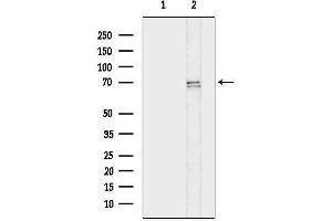 Western blot analysis of lysates from Hela cells(heat-shock treatment), using Acetyl-FOXO1A (Lys294) Antibody.