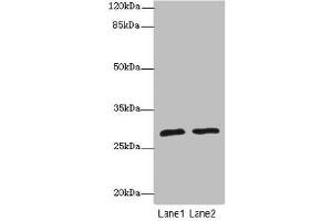 Western blot All lanes: APIPantibody at 1. (APIP 抗体  (AA 1-242))