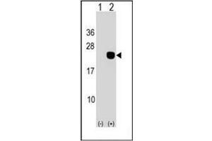 Western blot analysis of DCTD (arrow) using DCTD Antibody (N-term) Cat. (DCMP Deaminase (DCTD) (AA 1-30), (N-Term) 抗体)