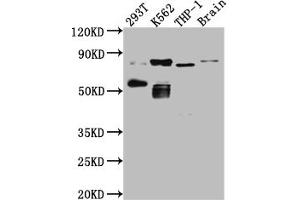 Western Blot Positive WB detected in: 293T whole cell lysate, K562 whole cell lysate, THP-1 whole cell lysate, Mouse Brain whole cell lysate All lanes: PKC antibody at 1:1000 Secondary Goat polyclonal to rabbit IgG at 1/50000 dilution Predicted band size: 82, 75, 68 kDa Observed band size: 82, 55 kDa (Recombinant PKC theta 抗体)