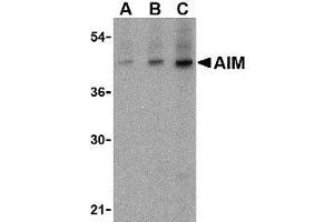 Western blot analysis of AIM in human lymph node tissue lysate with AP30035PU-N AIM antibody at (A) 1, (B) 2 and (C) 4 μg/ml. (CD5L 抗体  (N-Term))