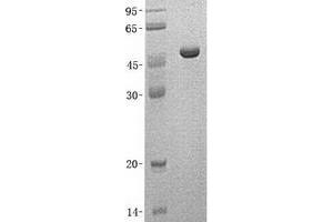 Western Blotting (WB) image for NAD Kinase (NADK) (Transcript Variant 3) protein (His tag) (ABIN2726775)