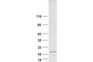 Validation with Western Blot (MAL Protein (Transcript Variant B) (Myc-DYKDDDDK Tag))