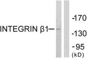 Western blot analysis of extracts from Jurkat cells, using Integrin beta1 (Ab-789) Antibody. (ITGB1 抗体  (AA 746-795))
