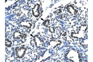 Claudin 17 antibody was used for immunohistochemistry at a concentration of 4-8 ug/ml to stain Alveolar cells (arrows) in Human Lung. (Claudin 17 抗体  (Middle Region))