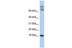 Image no. 1 for anti-Chemokine-Like Factor (CKLF) (N-Term) antibody (ABIN6741007) (CKLF 抗体  (N-Term))