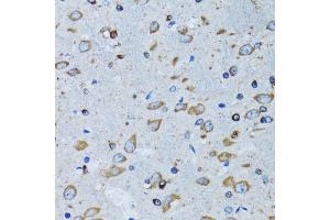 Immunohistochemistry (IHC) image for anti-Arginyl-tRNA Synthetase (RARS) (AA 1-300) antibody (ABIN6146708)