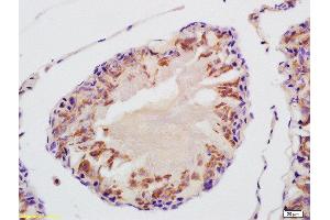 Immunohistochemistry (Paraffin-embedded Sections) (IHC (p)) image for anti-Voltage-Dependent Anion Channel 3 (VDAC3) (AA 101-200) antibody (ABIN872656)