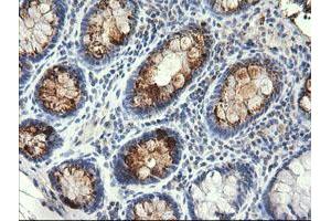 Image no. 1 for anti-serine/threonine Kinase 38 Like (STK38L) (AA 1-281) antibody (ABIN1490700) (STK38L 抗体  (AA 1-281))
