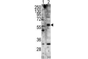 Western blot analysis of STK11 (arrow) using rabbit polyclonal STK11 Antibody . (LKB1 抗体  (N-Term))