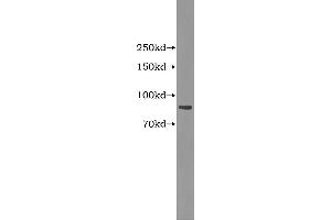Western Blotting (WB) image for Complement Factor B (CFB) ELISA Kit (ABIN1114331) (Complement Factor B ELISA 试剂盒)