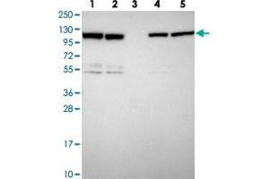 Western blot analysis of ZC3HAV1 polyclonal antibody . (ZC3HAV1 抗体)