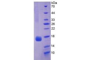 SDS-PAGE of Protein Standard from the Kit  (Highly purified E. (Myoglobin ELISA 试剂盒)