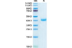 SDS-PAGE (SDS) image for Killer Cell Lectin-Like Receptor Subfamily B, Member 1 (KLRB1) (AA 67-225) protein (His-Avi Tag,Biotin) (ABIN7274083)