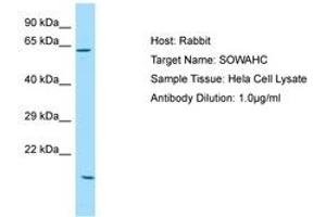 Image no. 1 for anti-Ankyrin Repeat Domain 57 (ANKRD57) (AA 425-474) antibody (ABIN6750152) (ANKRD57 抗体  (AA 425-474))