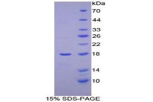 SDS-PAGE analysis of Human Hemoglobin Mu Protein. (Hemoglobin, mu 蛋白)