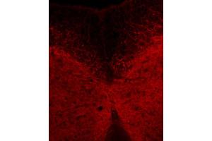 Immunohistochemistry (IHC) image for anti-Nicotinic Acetylcholine Receptor beta (CHRNB1) antibody (ABIN1742452)