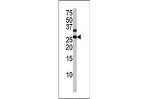 Image no. 1 for anti-Cyclin-Dependent Kinase Inhibitor 1B (p27, Kip1) (CDKN1B) (pThr187) antibody (ABIN358186) (CDKN1B 抗体  (pThr187))