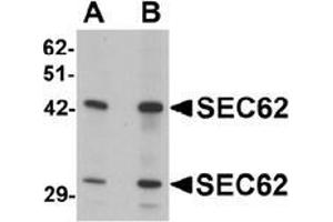 Western blot analysis of SEC62 in rat brain tissue lysate with SEC62 antibody at (A) 0. (SEC62 抗体  (C-Term))