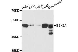 Western blot analysis of extracts of various cell lines, using GSK3A antibody (ABIN5970240) at 1/1000 dilution. (GSK3 alpha 抗体)